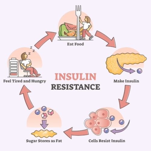 Insulin resistance diagram for women who may need an opgyn doctor in Idaho Falls.