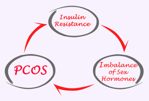 PCOS diagram for women who may need an opgyn doctor in Idaho Falls.