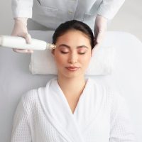 Woman receiving a Potenza aesthetics skin procedure in Idaho Falls at Rosemark, formally a Bella Dea spa procedure