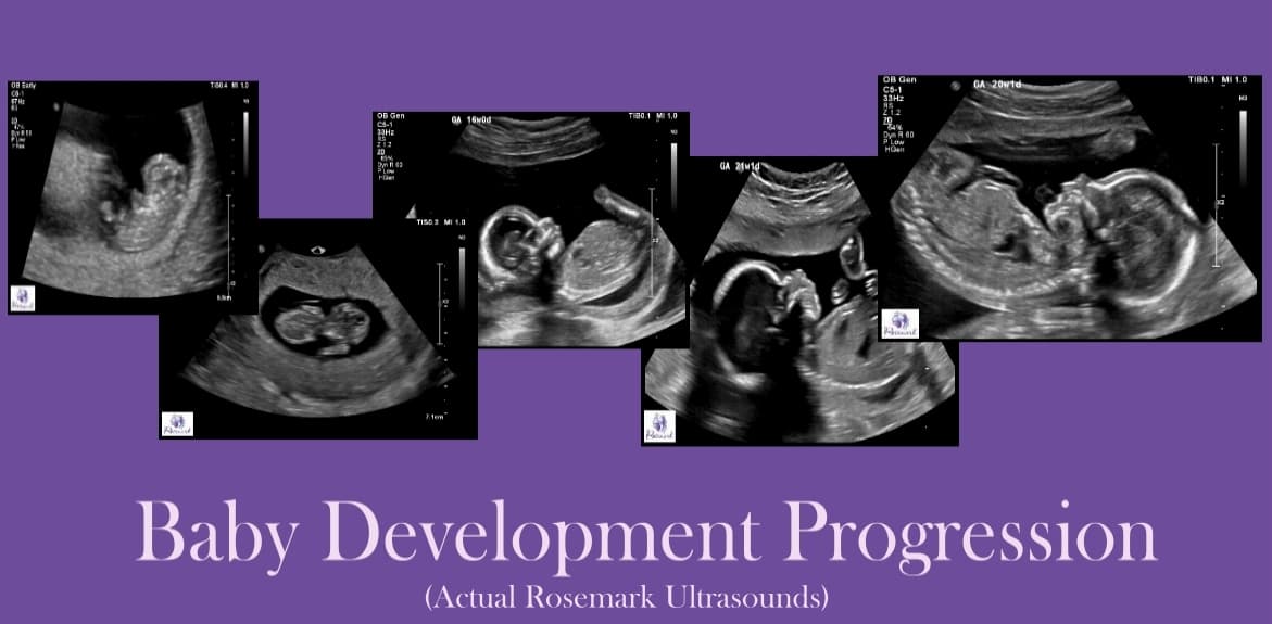 Ultrasound pictures from Rosemark in Idaho Falls.
